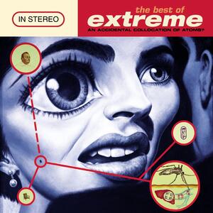 Extreme – Hip today